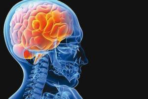 چرا به کسی که دچار سکته مغزی شده نباید قرص فشار خون داد؟