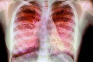 MRI تنها با استنشاق گاز مغناطیسی