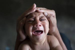 زیکا و نگرانی‌ها در مورد سقط جنین