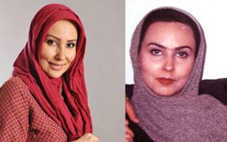 بازیگران ایرانی، قبل از عمل بعد از عمل! + تصاوير