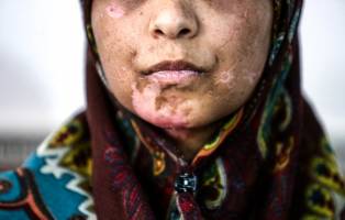 پیگیری مولاوردی از وضعیت زن شکنجه دیده مشهدی