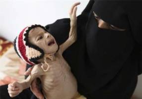 یمن با فاجعه انسانی روبه رو است
