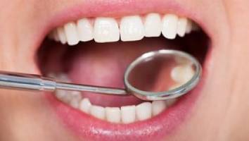 5 غذای شگفت‌انگیز برای داشتن دندان‌های سالم
