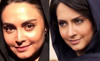 بازیگر زن کشورمان از جراحی زیبایی خود پشیمان شد! + تصاویر