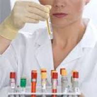 تشخیص پارکینسون با آزمایش ادرار 