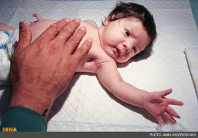 جلوگیری از تولد نوزادان معلول در لیست برنامه‌های بهزیستی