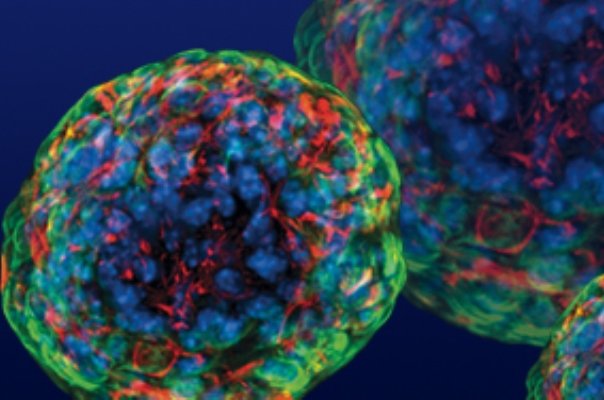 محققان کشور آنتی بیونتیک نانویی تولید کردند