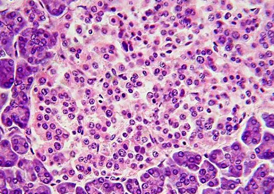 سلول های بنیادی و نقش آنها در درمان نوعی سندرم 