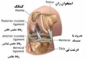 افزایش میزان آسیب دیدگی ACL در کودکان ورزشکار