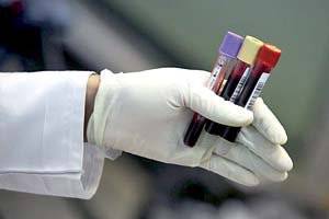 مخالفت کارشناسان با «اجباری شدن آزمایش ژنتیک»