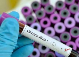 ضرر ۴ تریلیون دلاری شرکت‌های آمریکایی از ویروس کرونا