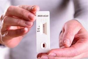ایران کمبود کیت تشخیص کرونا دارد؟