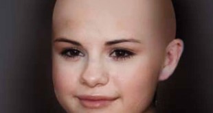 سلنا گومز شیمی درمانی شد!