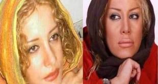 تصاویر دیدنی 12 بازیگر زن ایرانی، قبل و بعد از عمل زیبایی